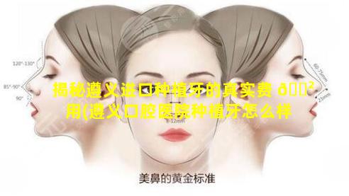 揭秘遵义进口种植牙的真实费 🌲 用(遵义口腔医院种植牙怎么样)